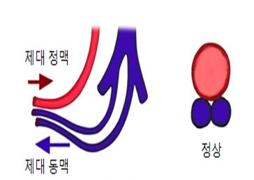 탯줄(Umbilical cord) | 인체정보 | 의료정보 | 건강정보 | 서울아산병원